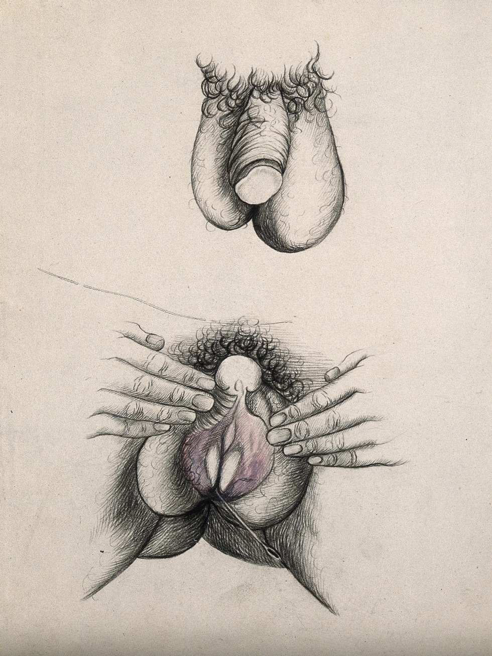 Imitation of a vagina from a scrotum