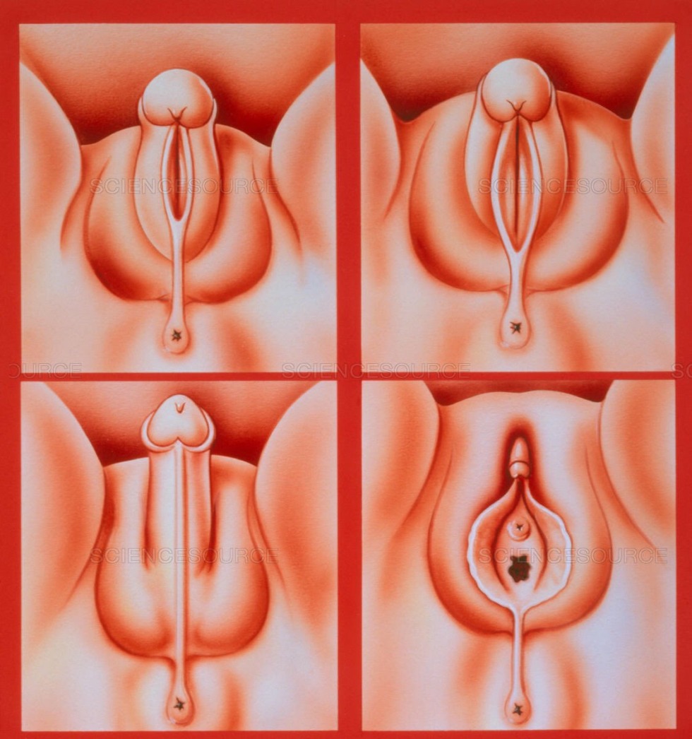 Vaginal formation