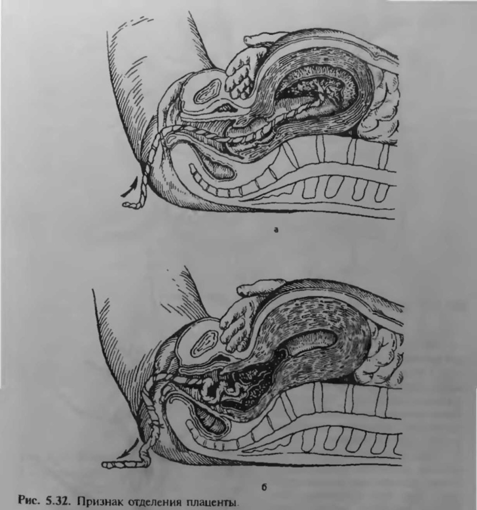 Introduction of a member in the vagina