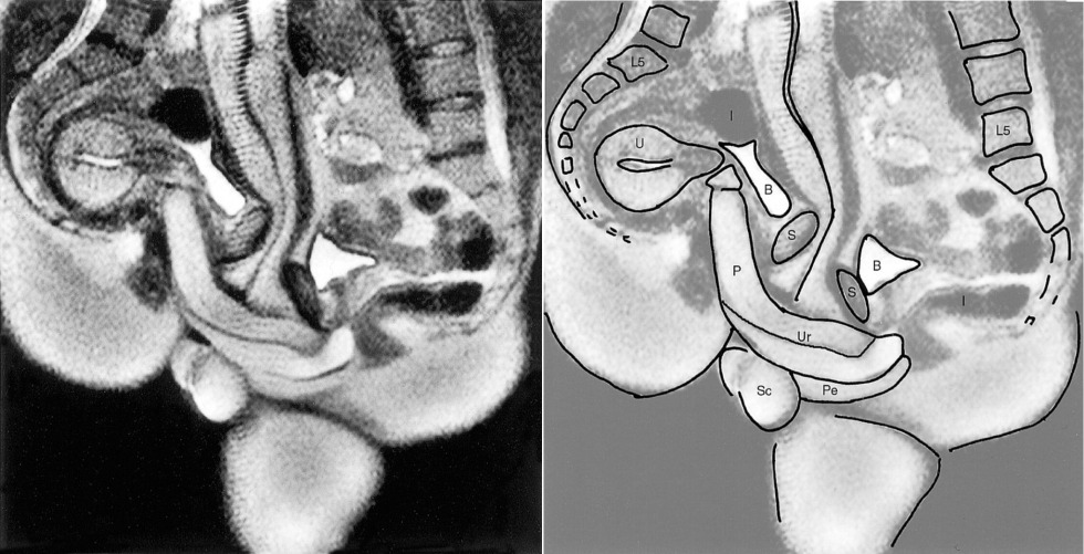 Intercourse in the section
