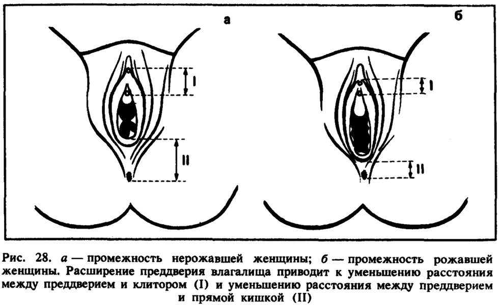 The difference that gave birth to and unbroken vagina
