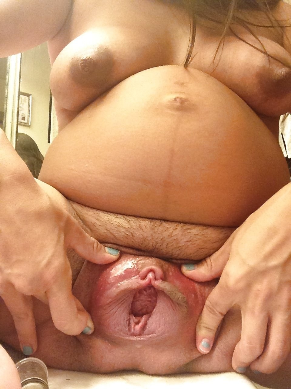 Open vagina after childbirth