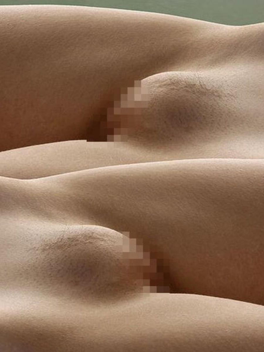 Girls with a bulging pubis