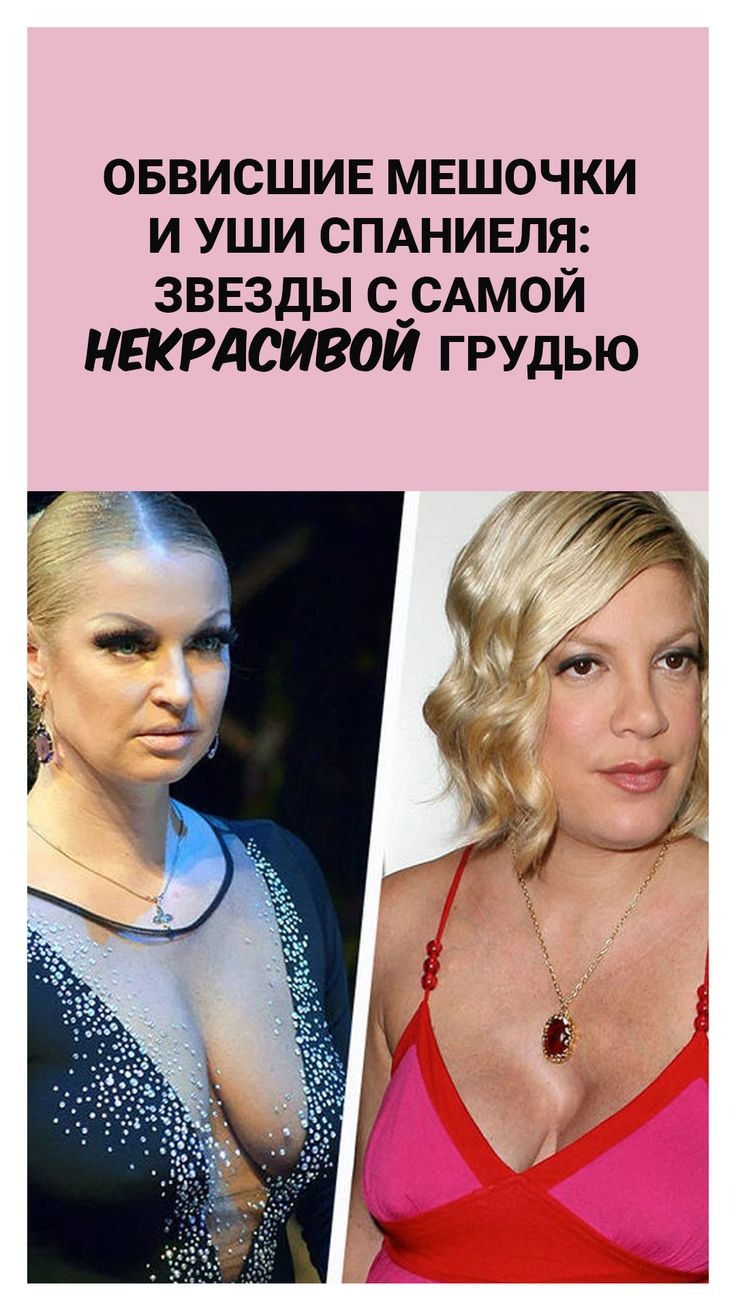 Breast shape of spaniel