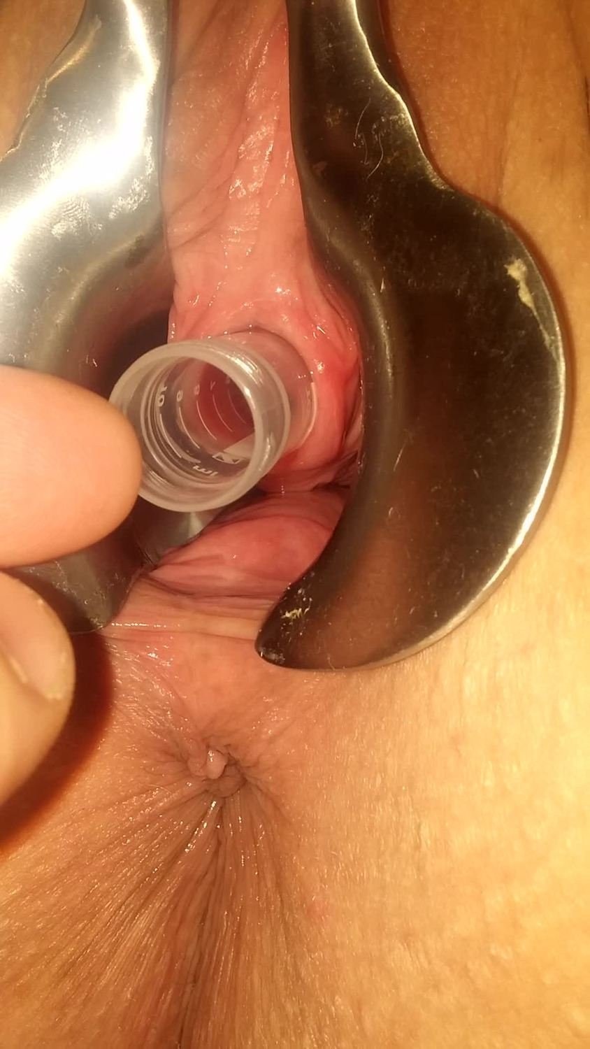 Women's urethral masturbation