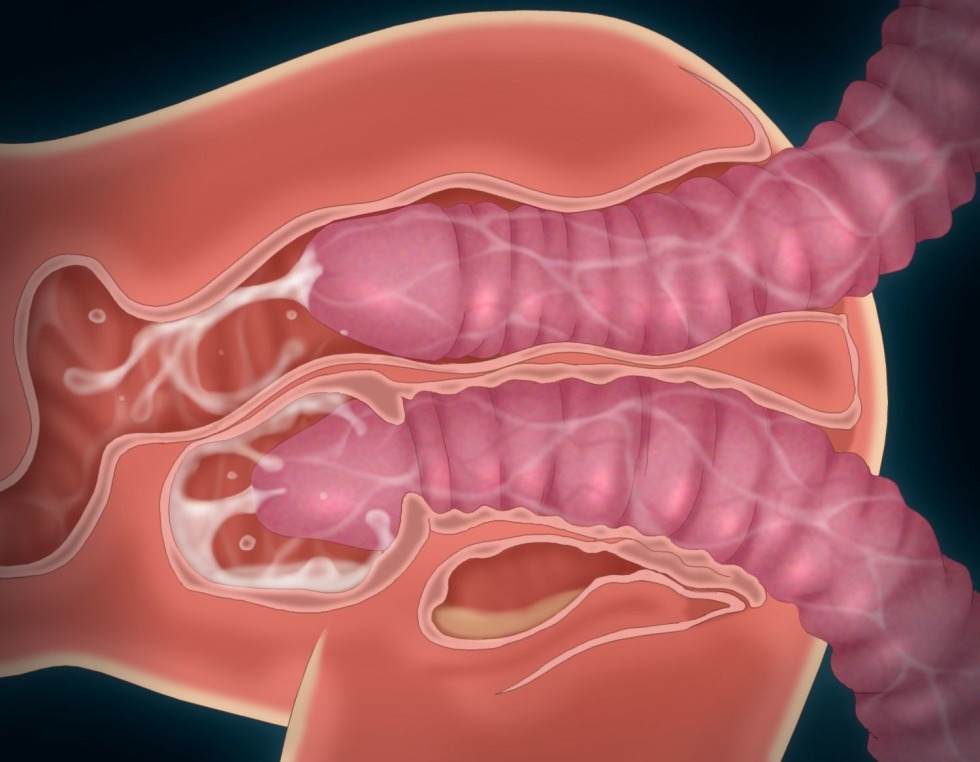 Member inside the anus in context