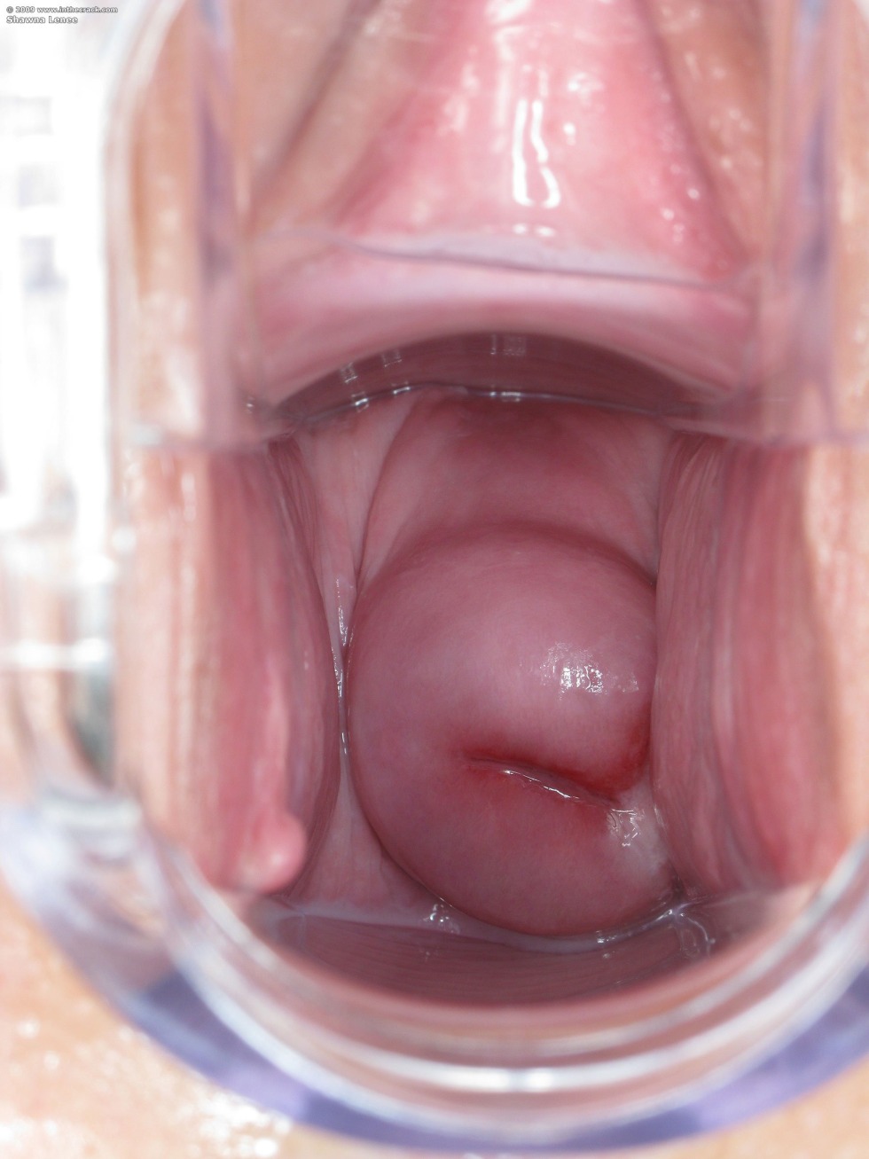 The structure of the vagina photo