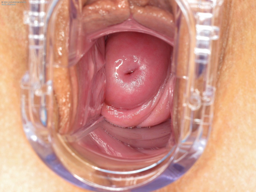 The camera inside the vagina