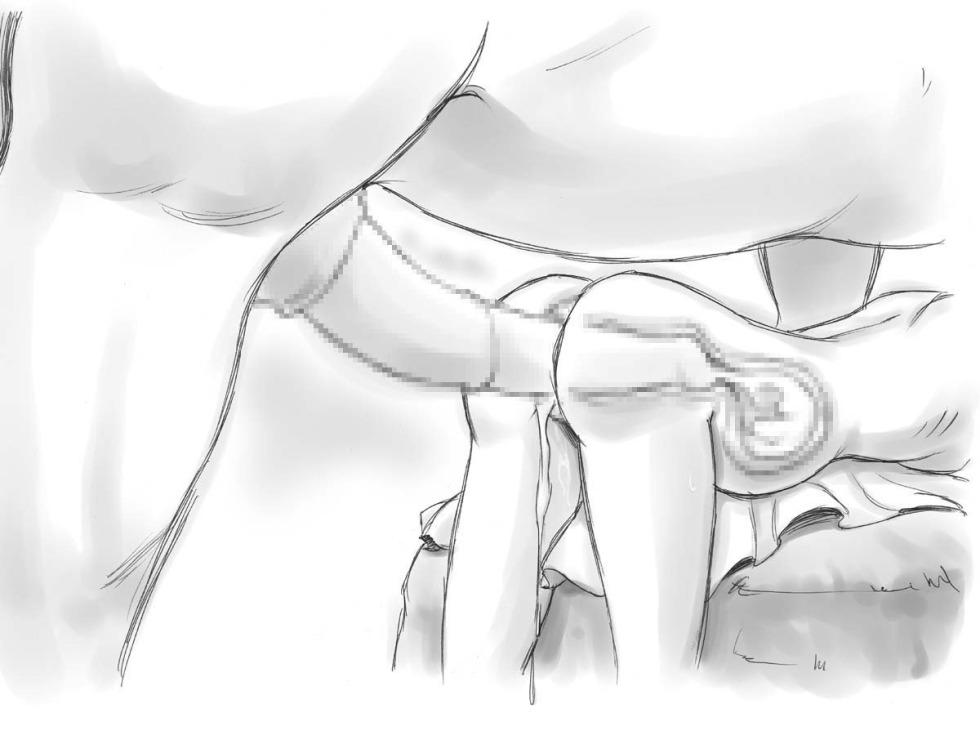 Scheme of penetration of a member into the vagina