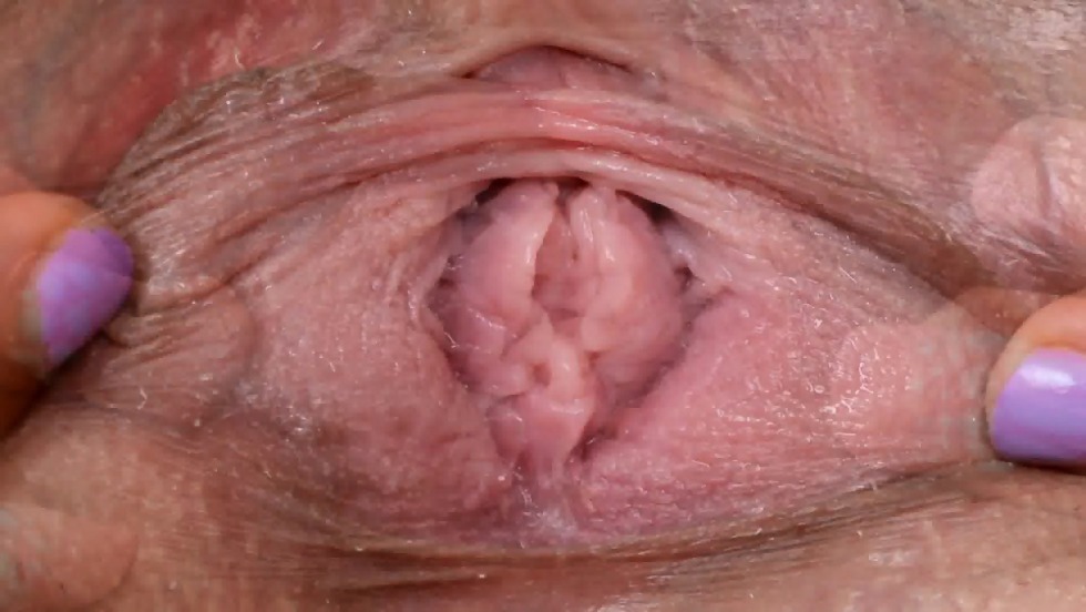 The vagina of a healthy woman