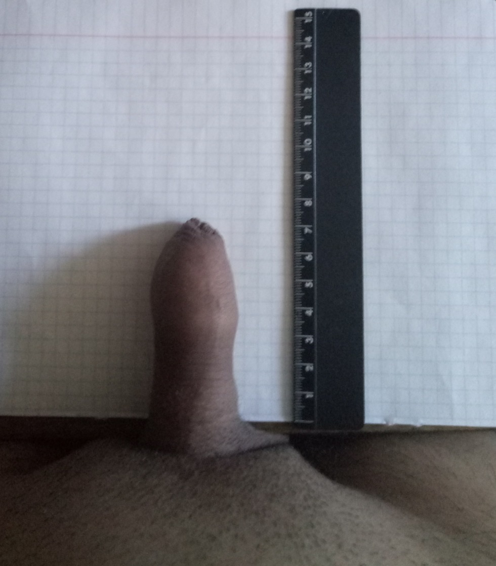 Small dick 10 centimeters