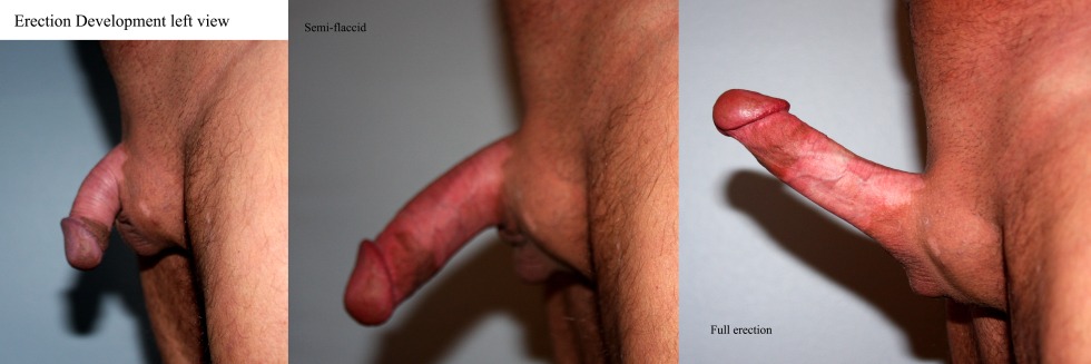 Penis Full Erect Flaccid and with Cum, Outdoor