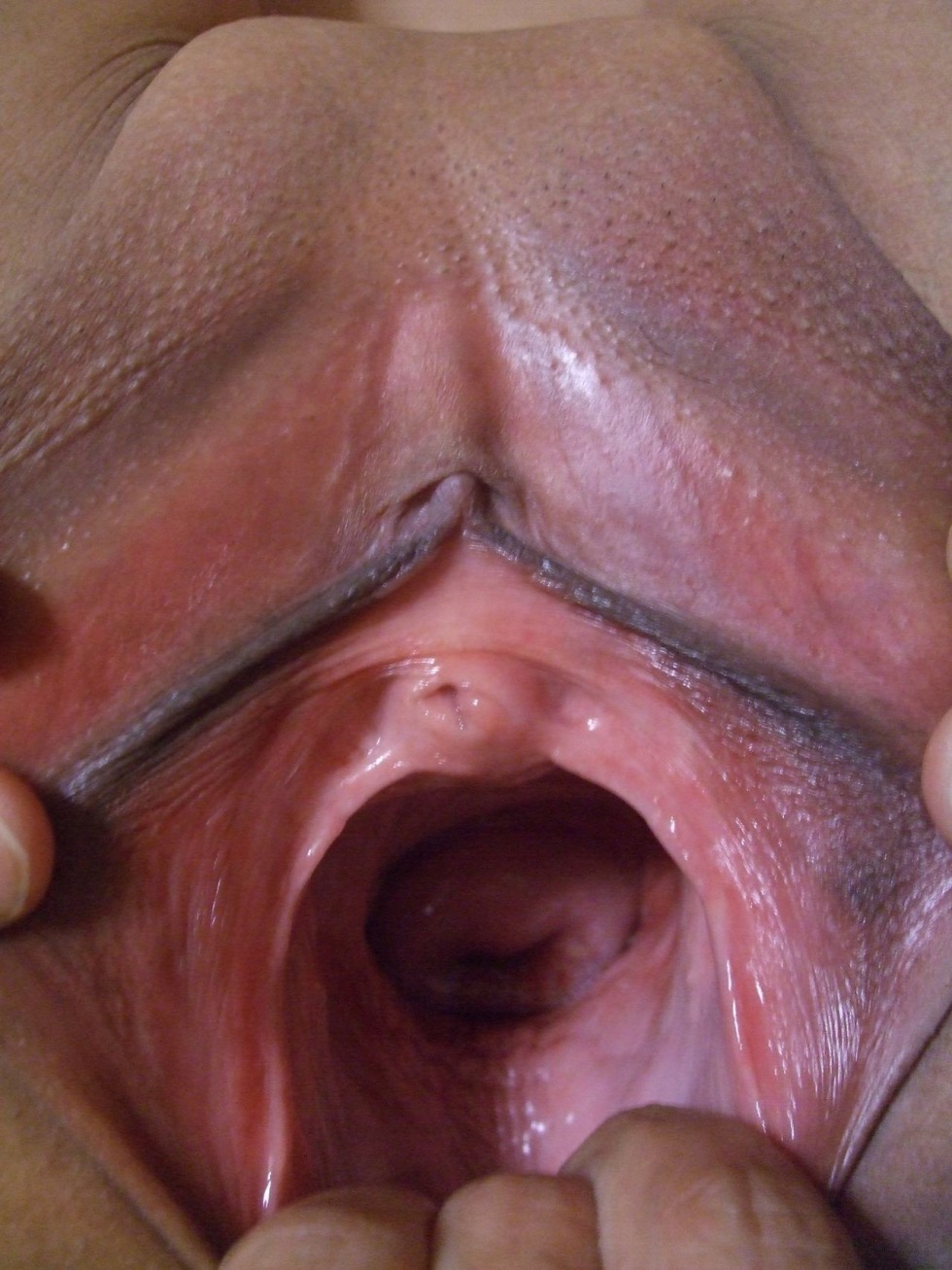 Solo, Posing, Speculum, Gaping, Close Ups XXX