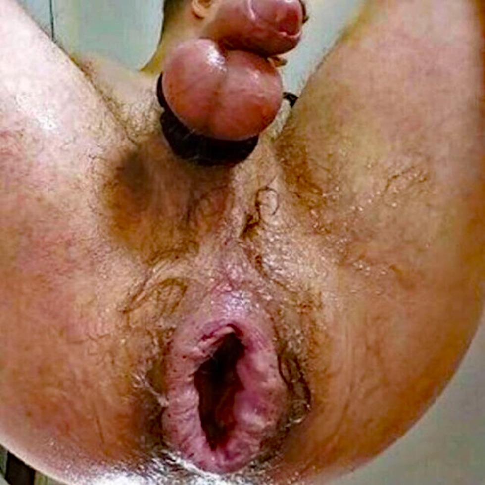 Anal hole of a man