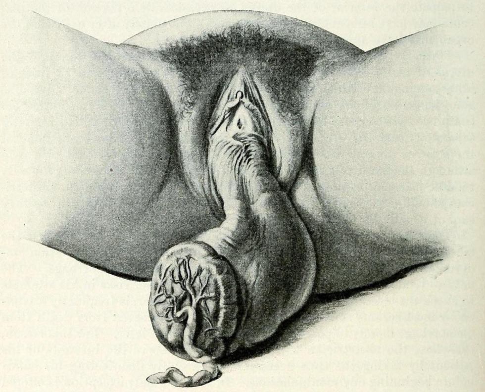 Drawings of female genitals