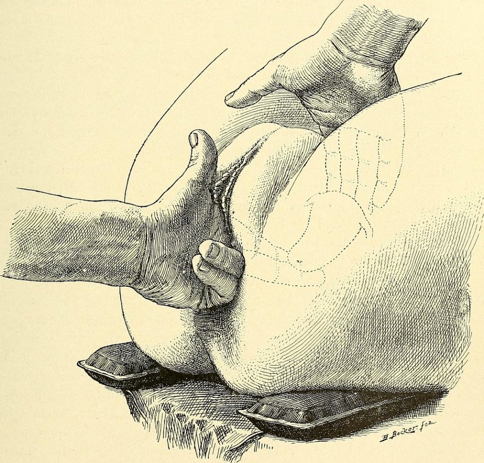 Scheme of penetration of a member into the vagina