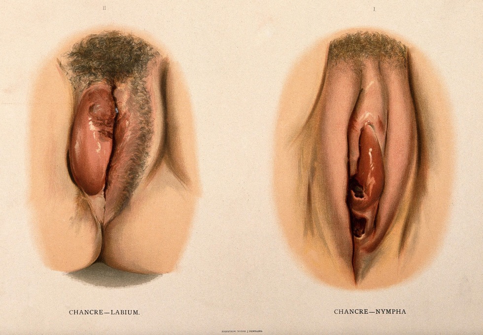 Face and female genitals