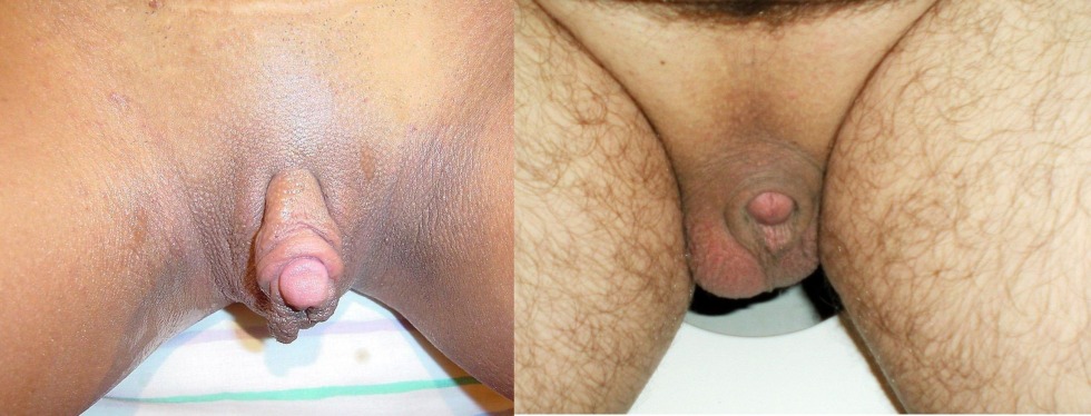 Male and female genitals