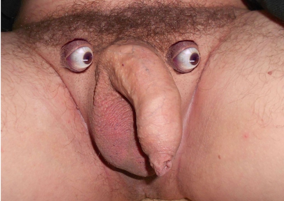 Ugly male dick