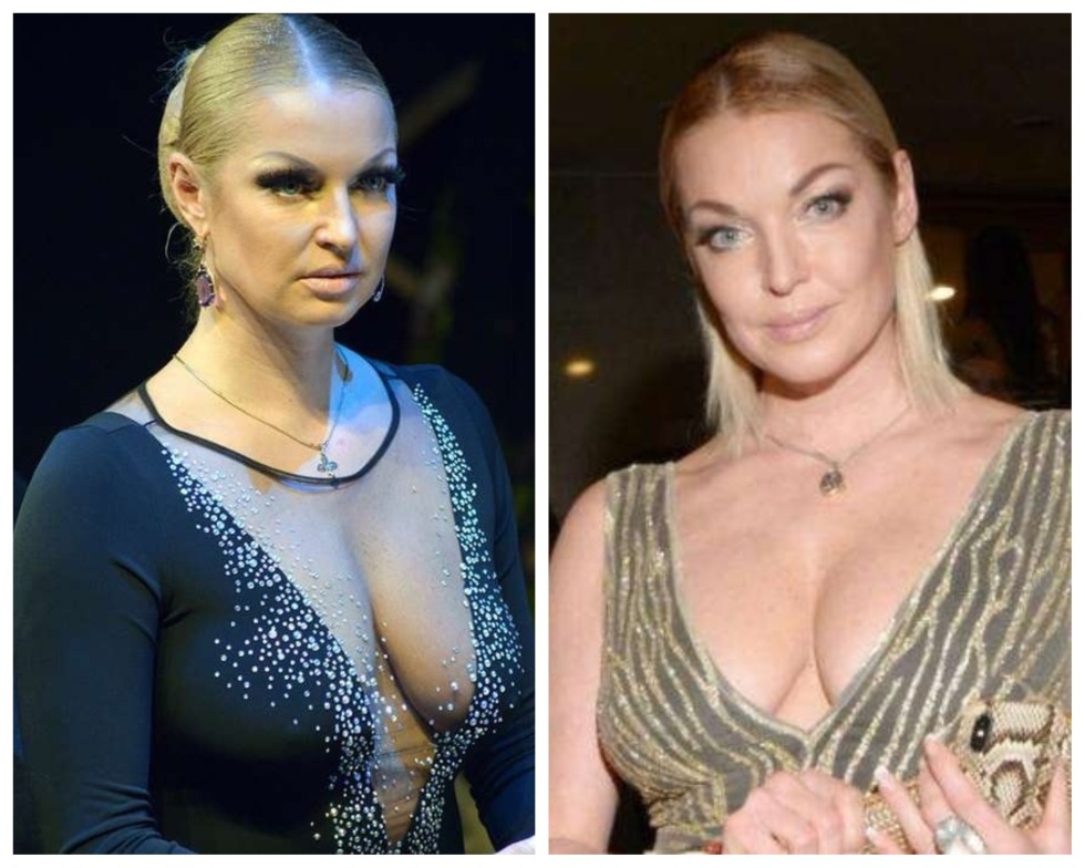 Stars with a sagging bust