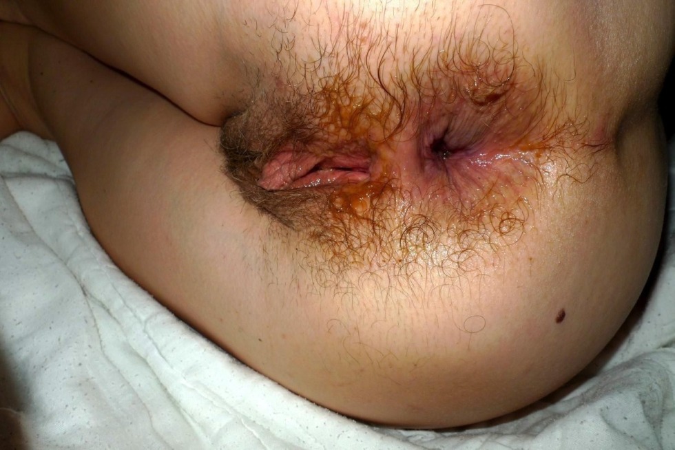 Dirty hairy female anus