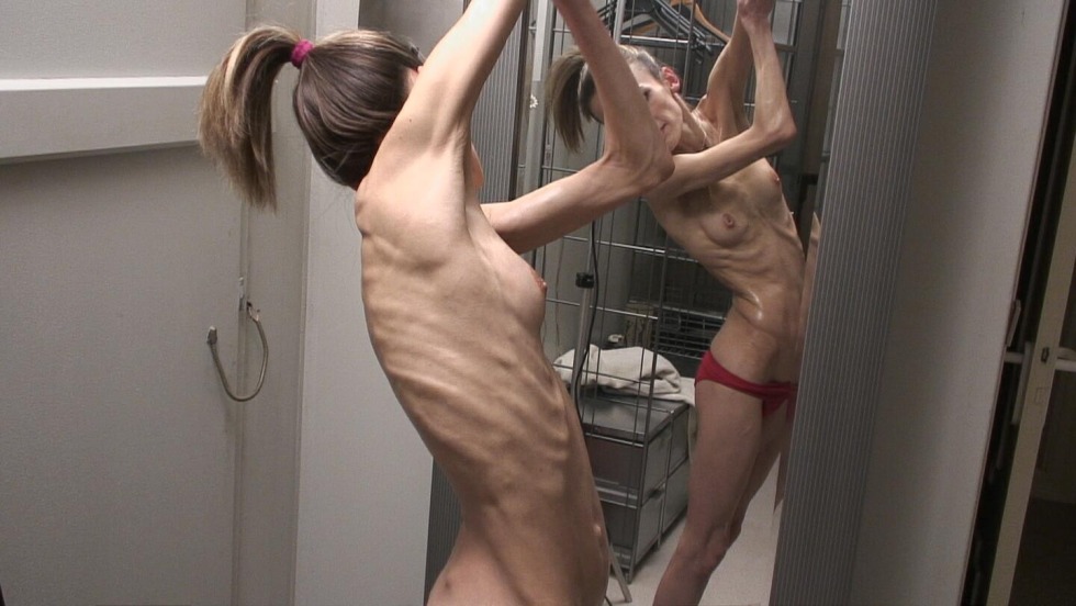 Anorexia thin private nude