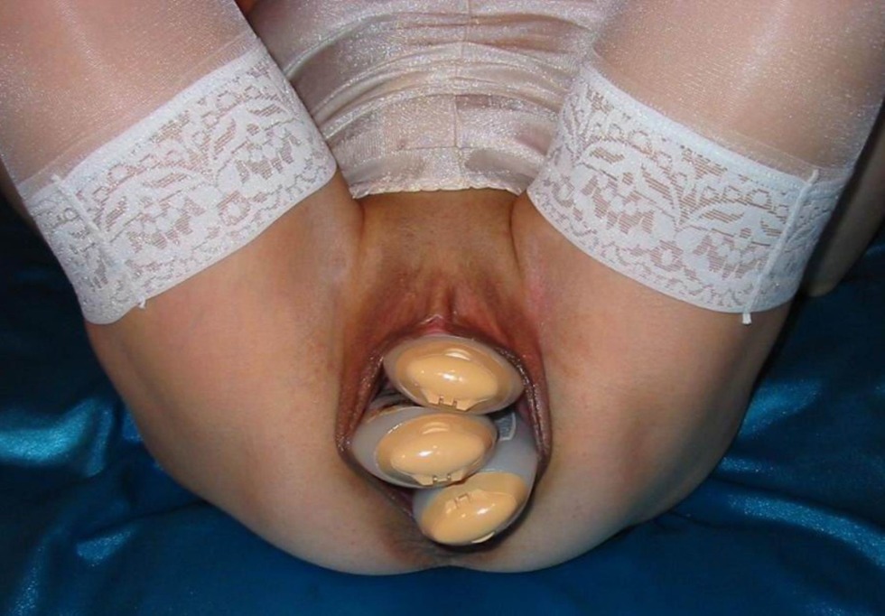 Strange objects in the vagina