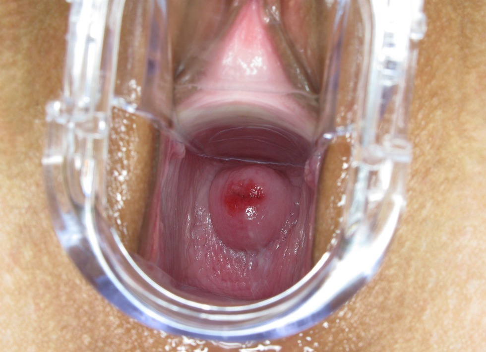 Women's vagina inside