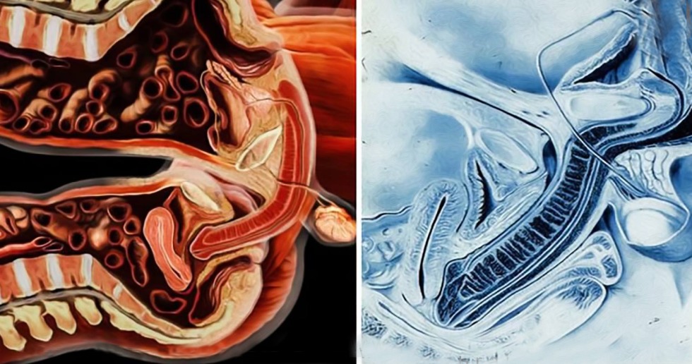 Vagina from the inside in the section