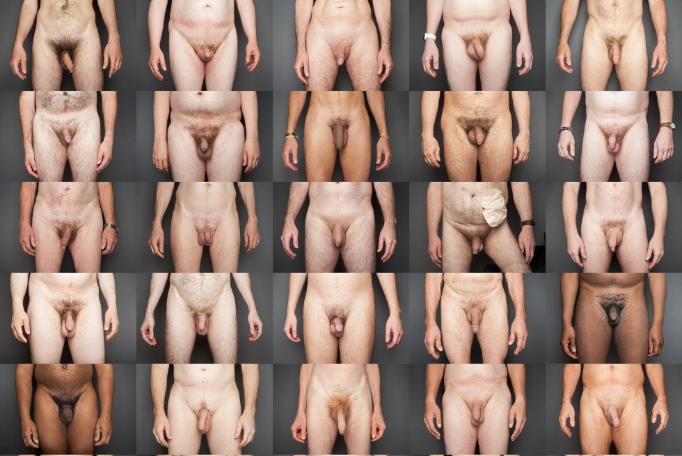 Unusual forms of genital organs