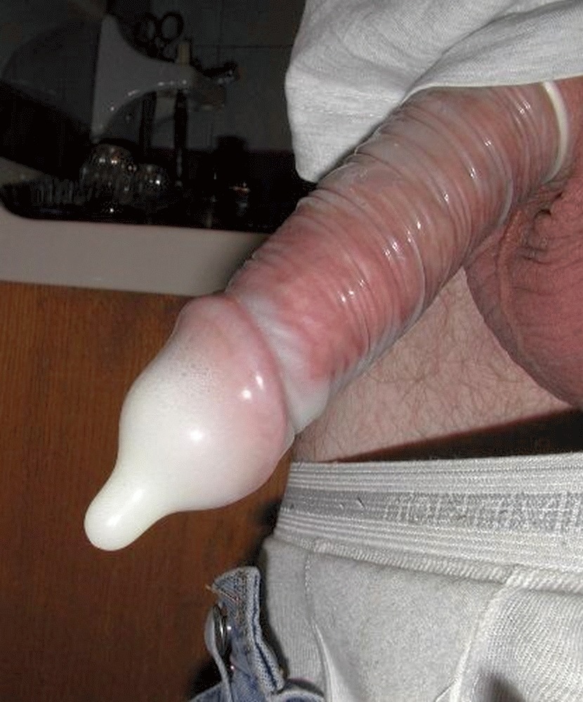 Black condom on the penis