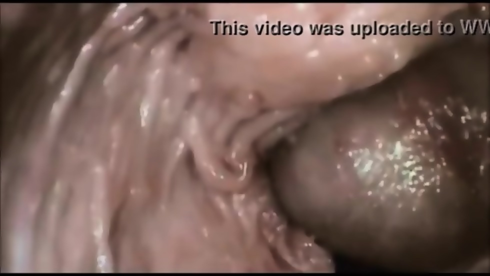 A video camera inside the vagina