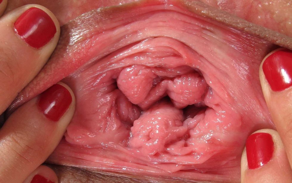 Healthy vagina inside