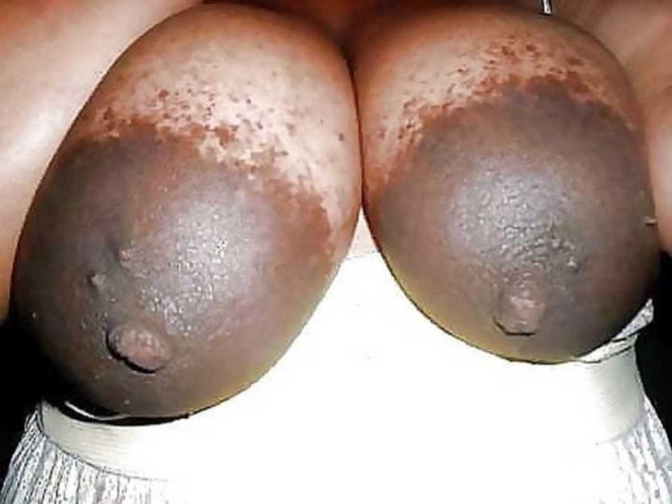Huge brown nipples