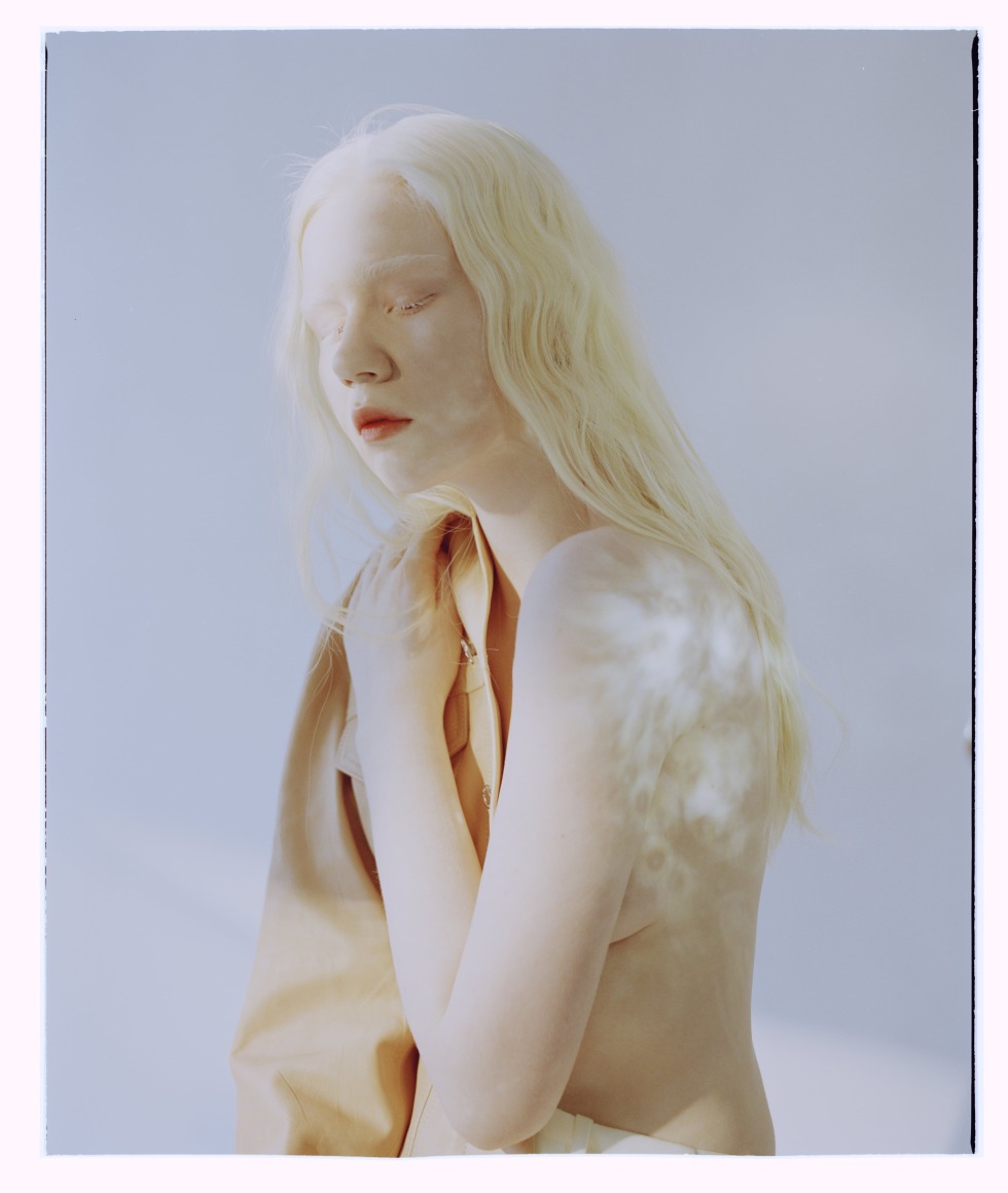 The girl Albino is naked