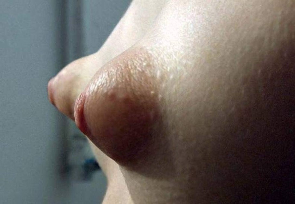 Breasts with convex nipples