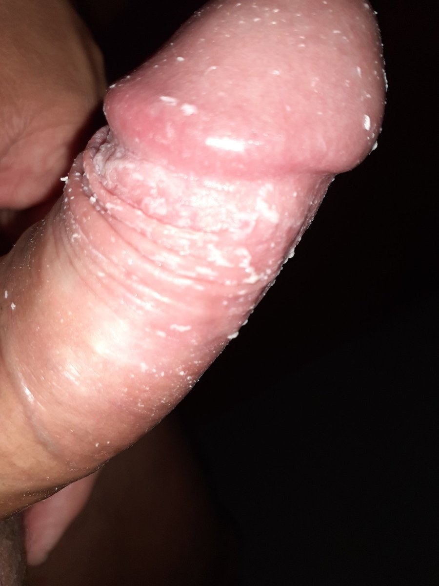 Smegma in men photo penis