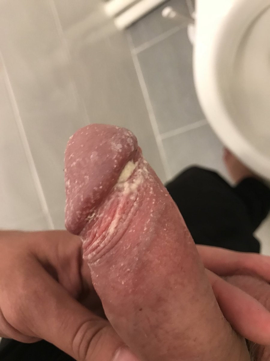 White raid on the clitoris and itches