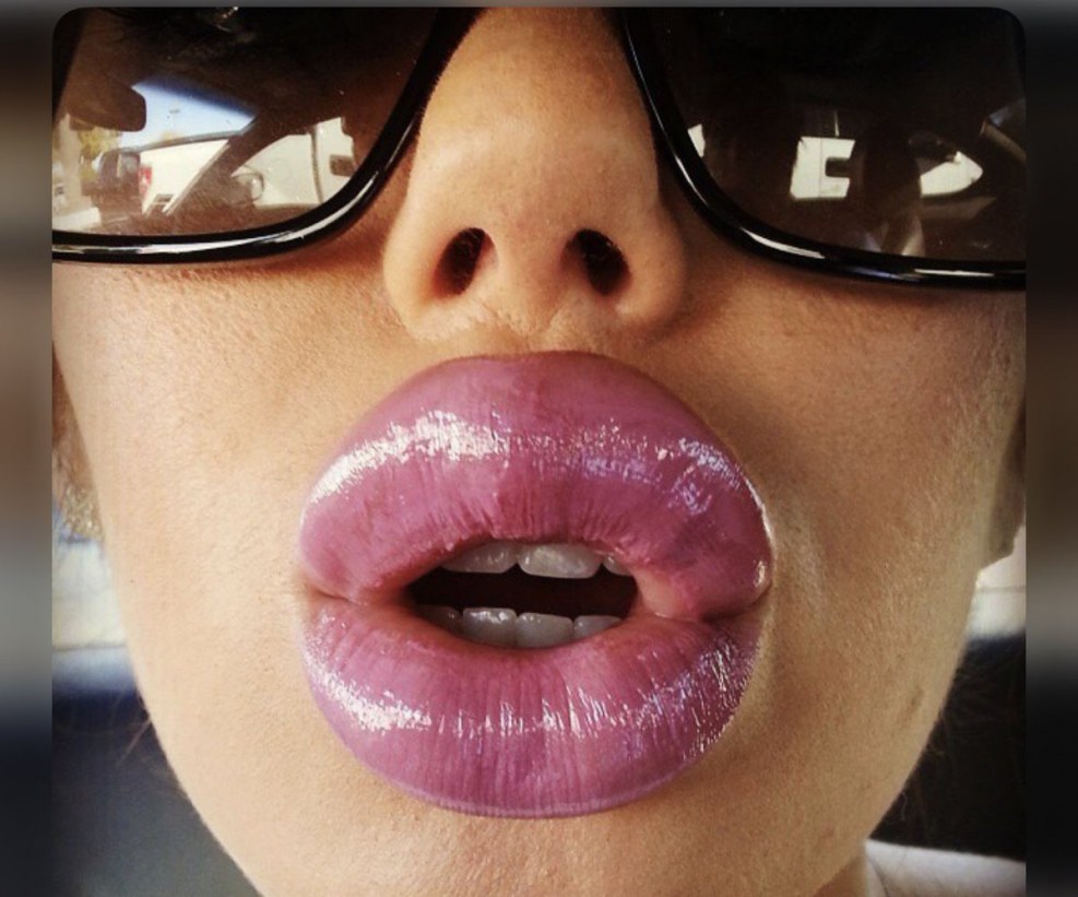 Silicone tits and lips