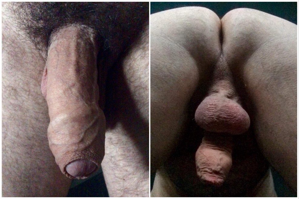 Extreme flesh close-up