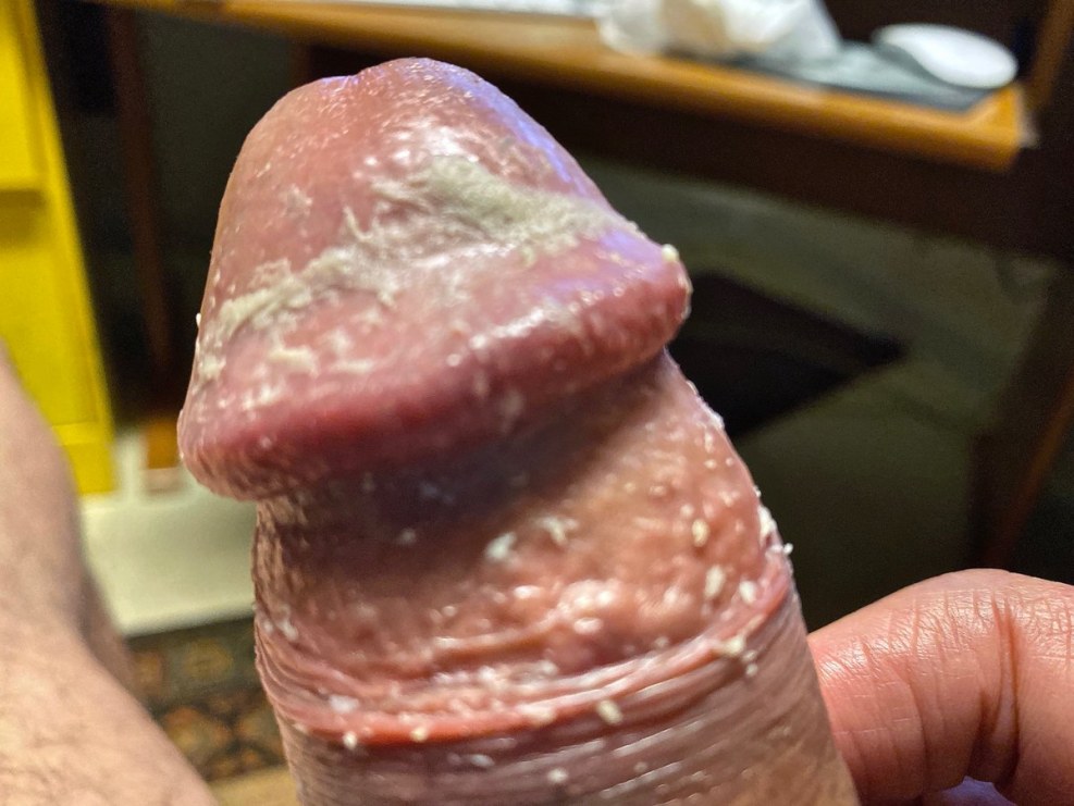 Smegma on a cockfilm member