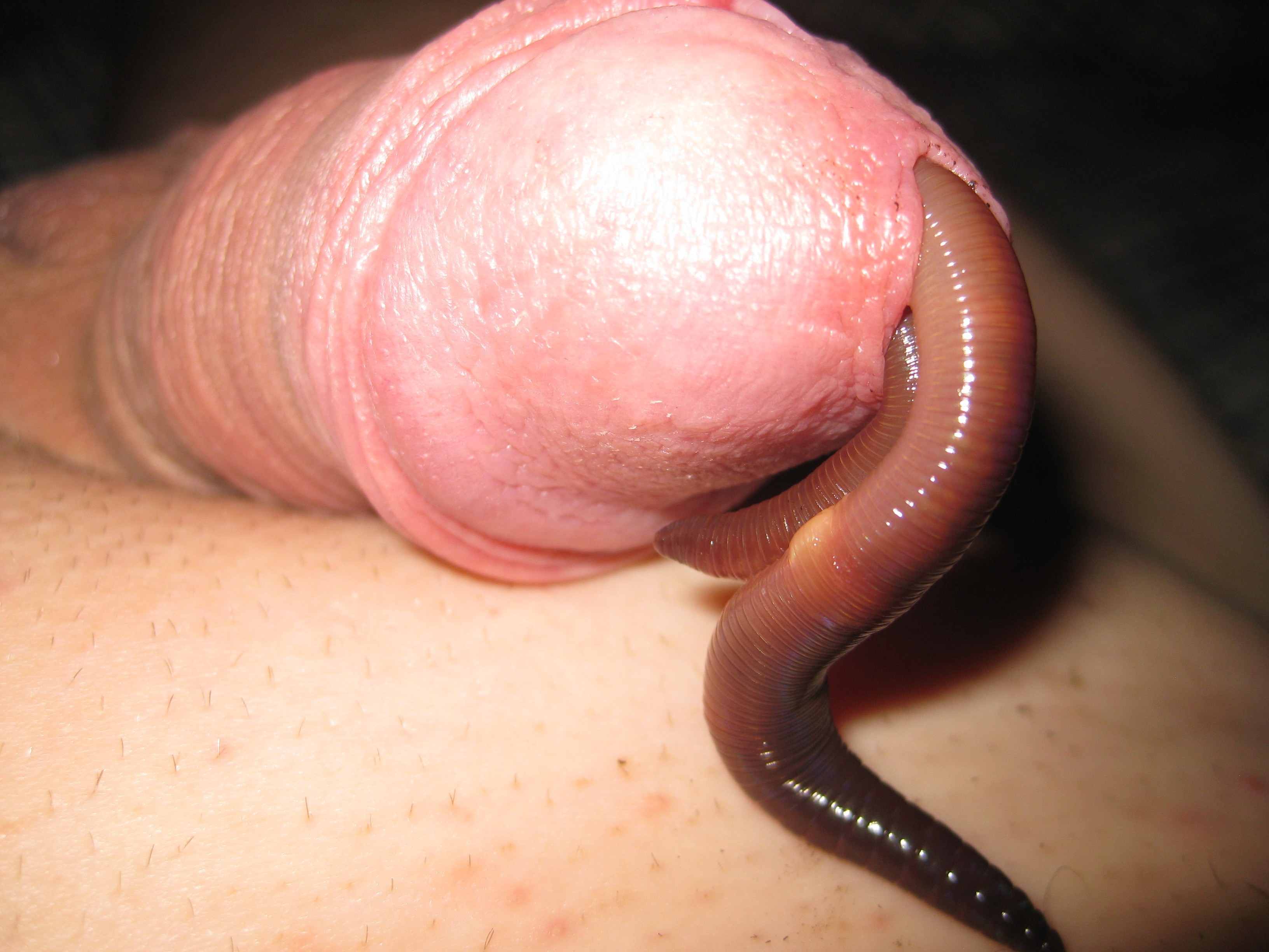 Worm in mans dick