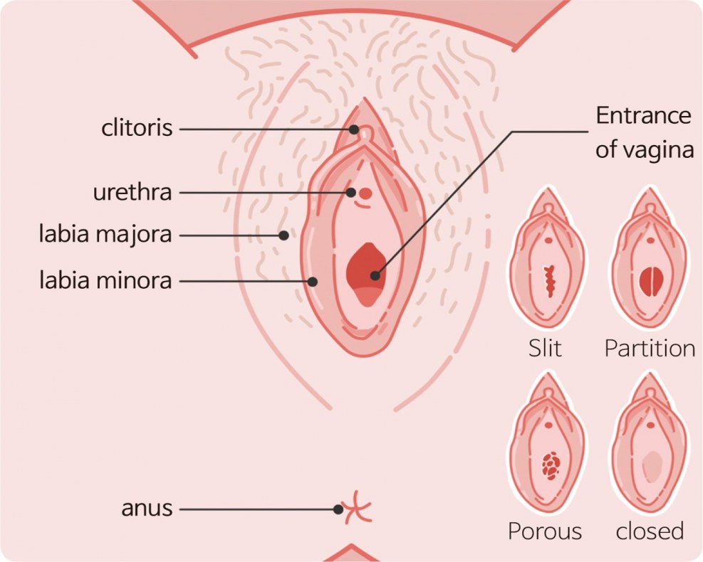 Women's panties in lubrication