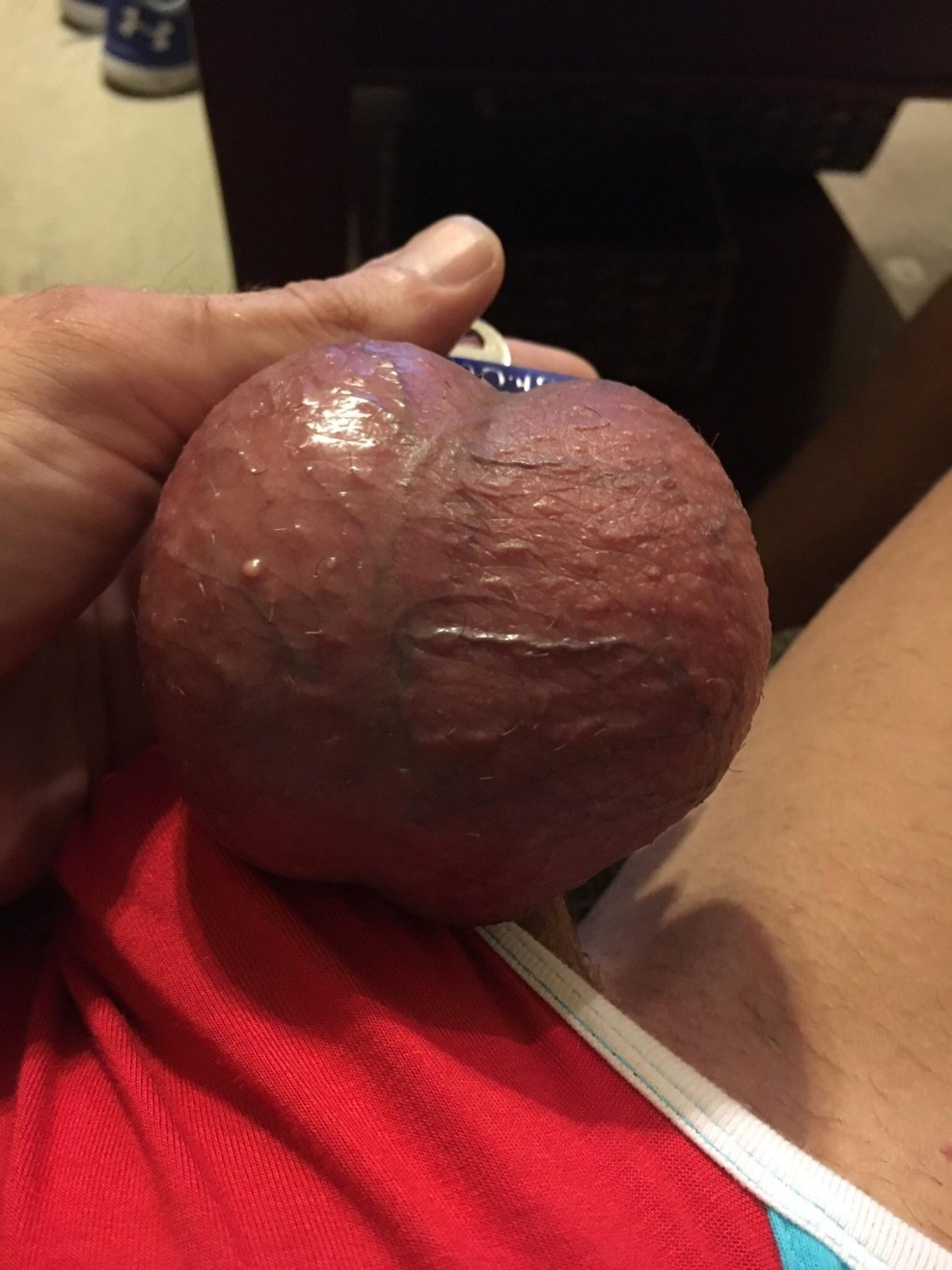 Badly began to stand member