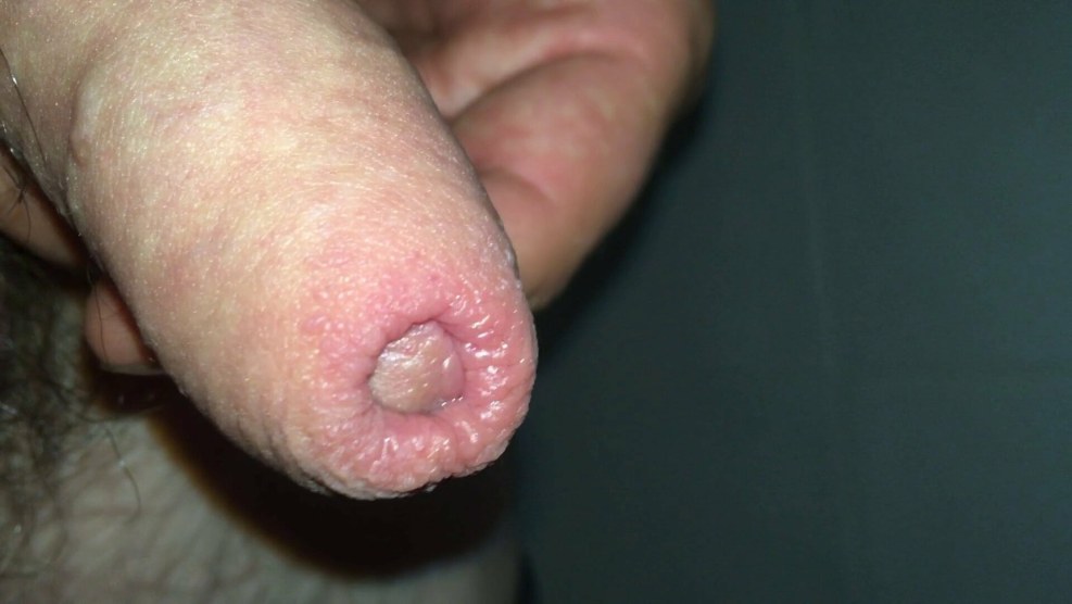 Extreme Flesh Cum