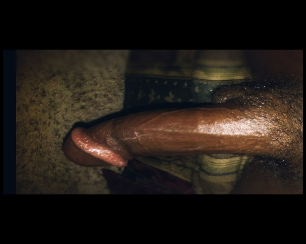 Torn mouth from a member