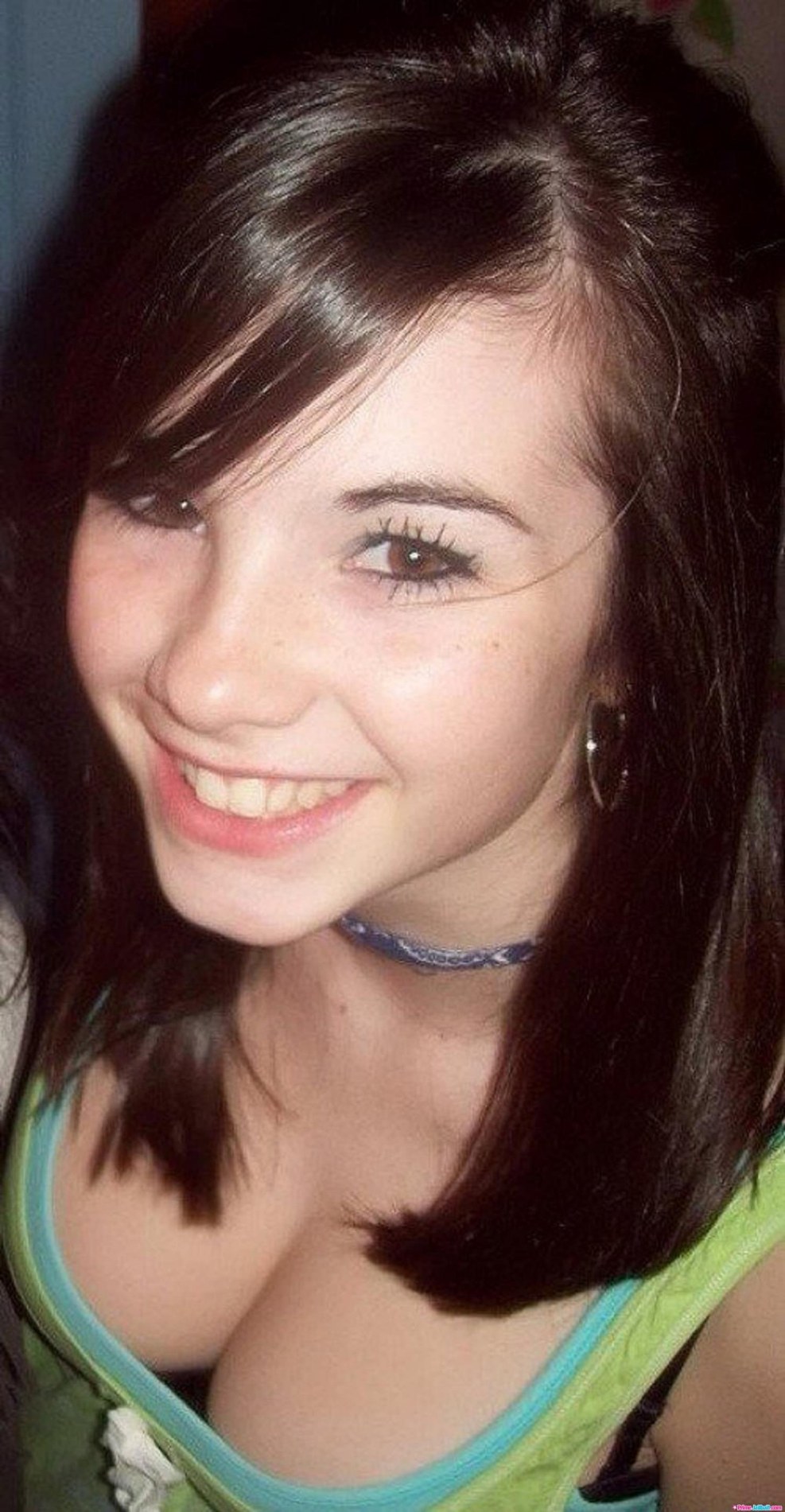 Polostenic teenager in a bikini