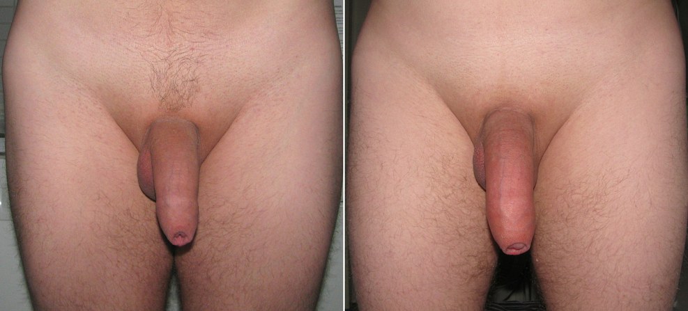 Nurse and naked CFNM patient