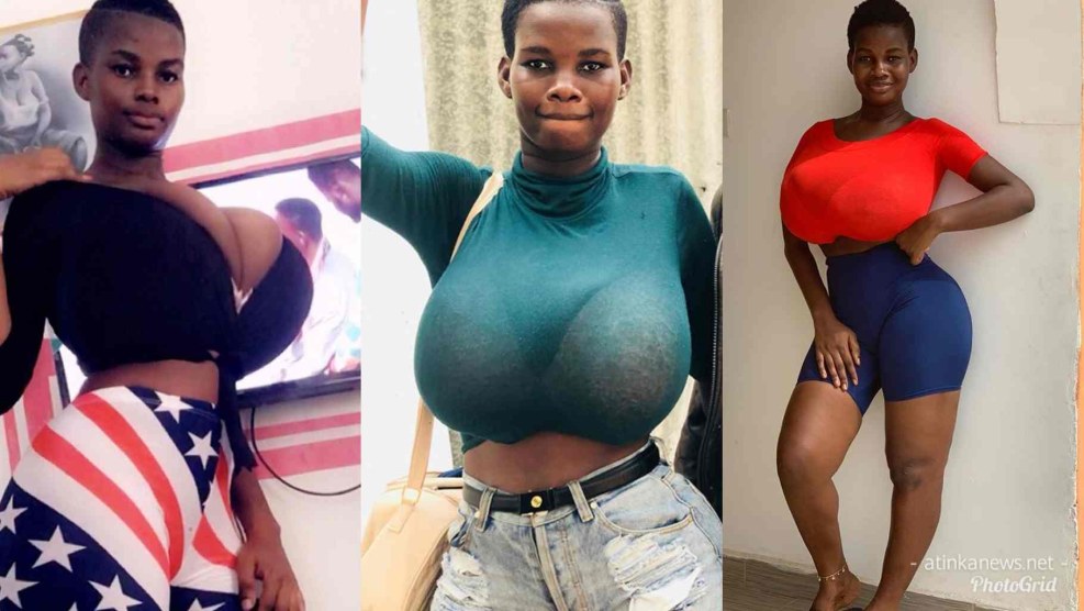 Pamela Odame_watara breast