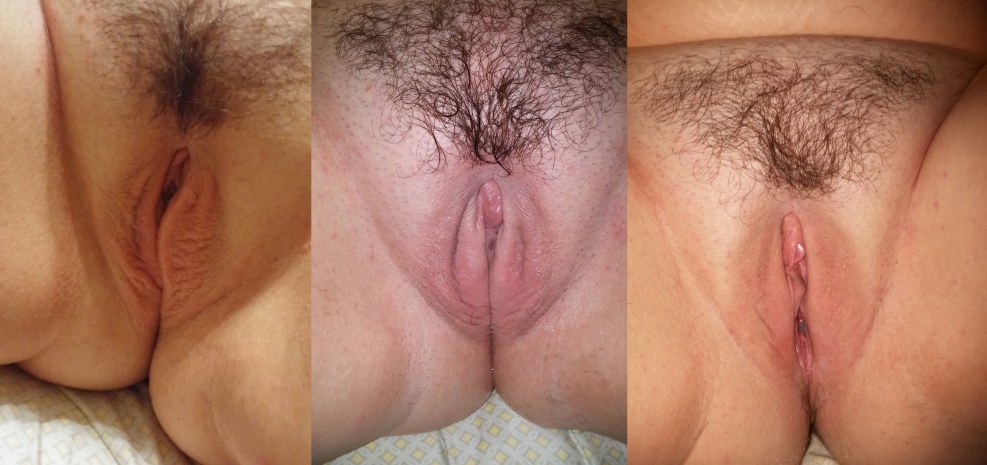 Vagina Close -up Before and After